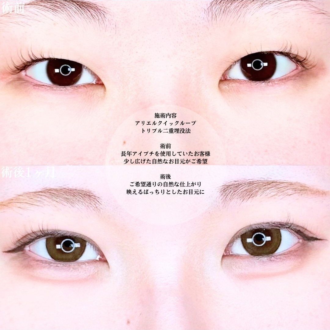 No.19323の症例写真1