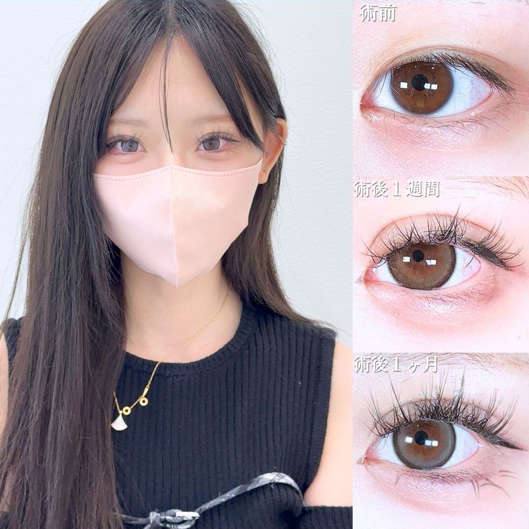 No.19117の症例写真