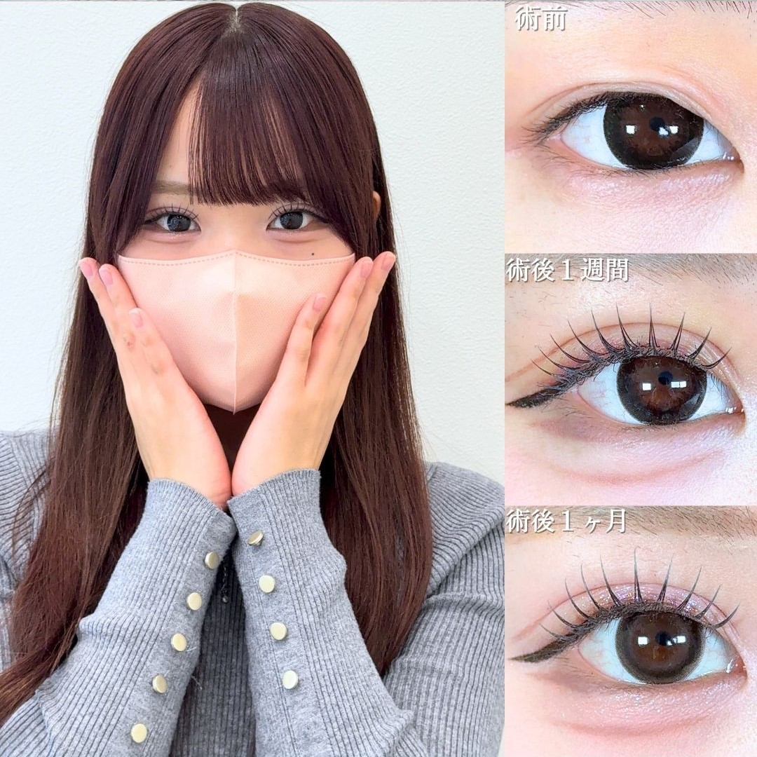 No.19156の症例写真