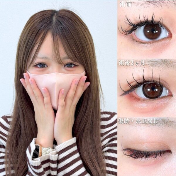 No.18997の症例写真