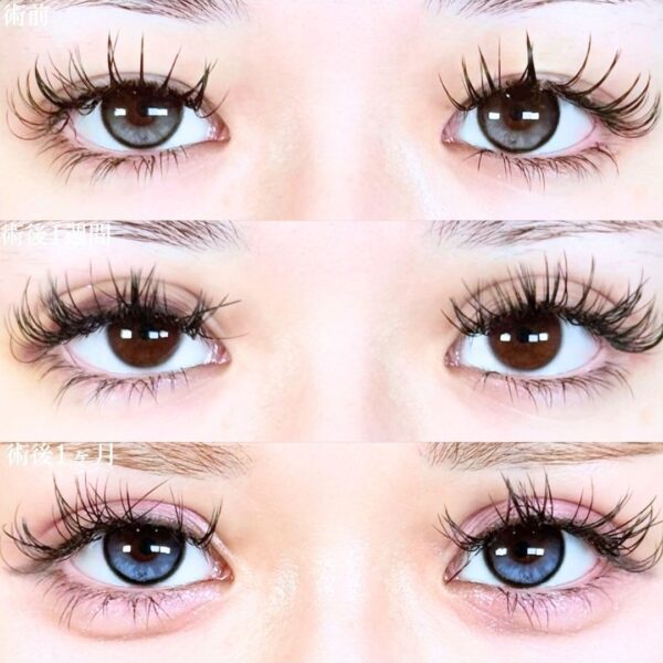 No.19222の症例写真