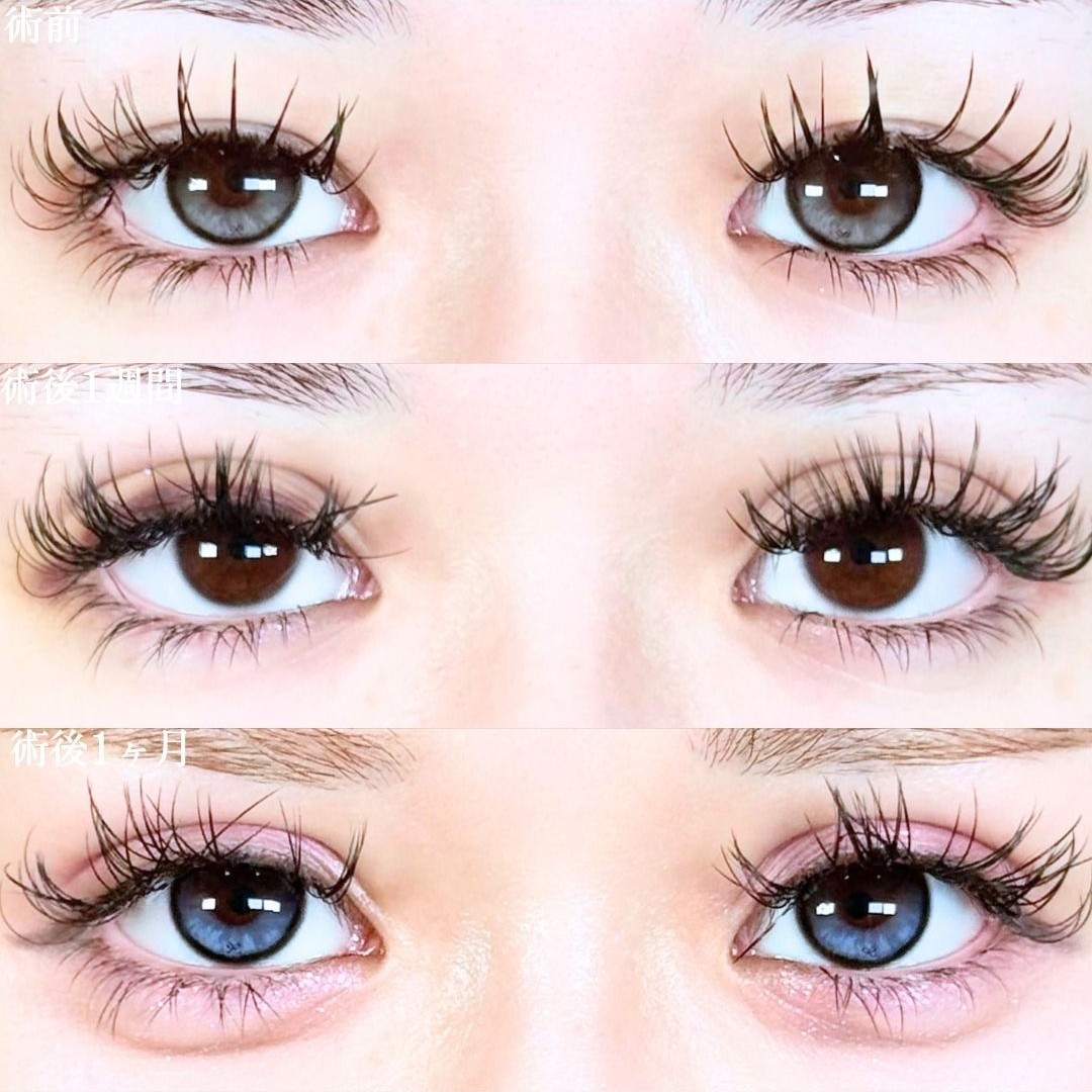 No.19222の症例写真