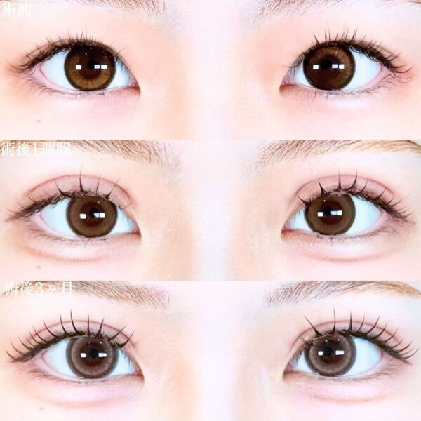 No.19245の症例写真