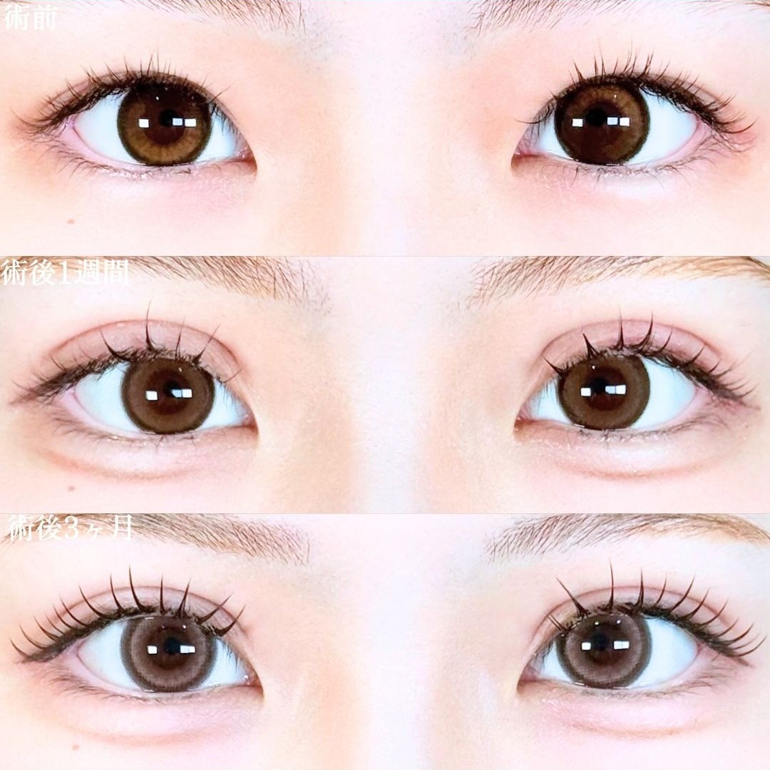 No.19245の症例写真