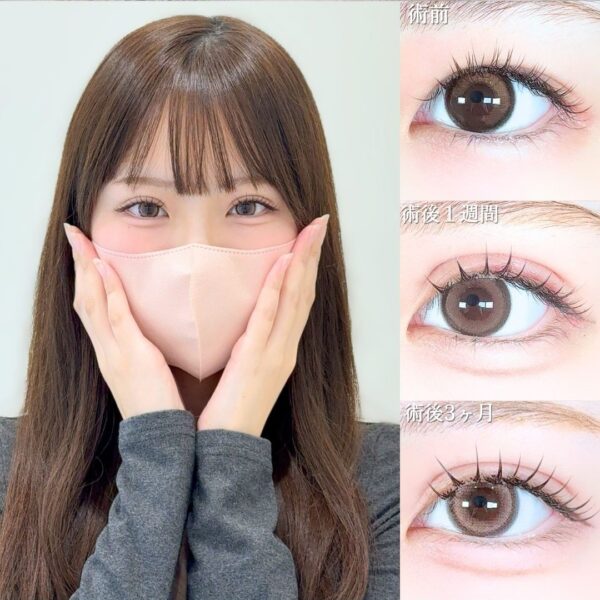 No.19265の症例写真