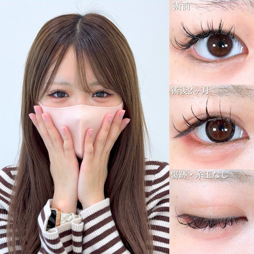 No.18997の症例写真