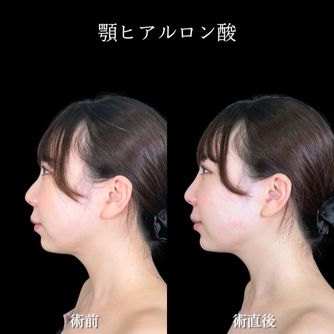 No.19020の症例写真2