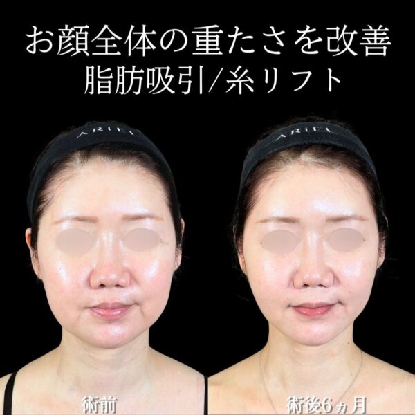 No.19432の症例写真