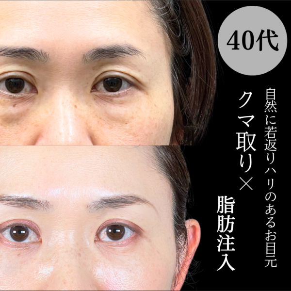 No.19410の症例写真