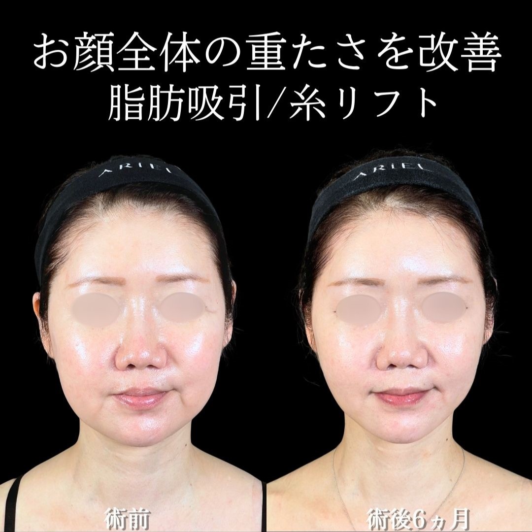 No.19432の症例写真