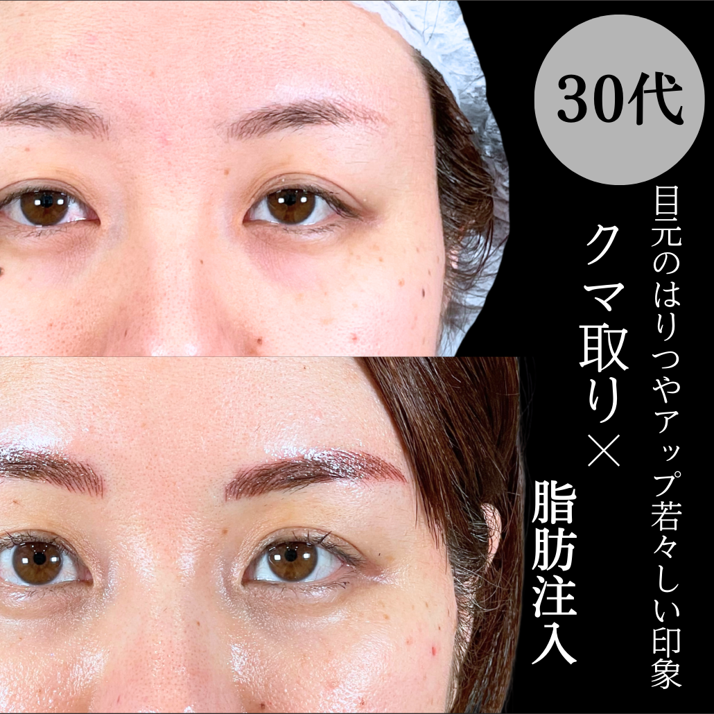 No.19650の症例写真