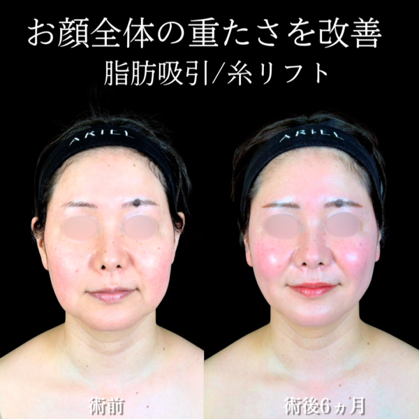 No.19640の症例写真