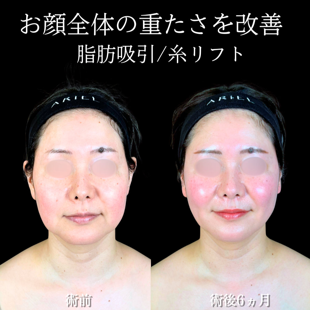 No.19640の症例写真