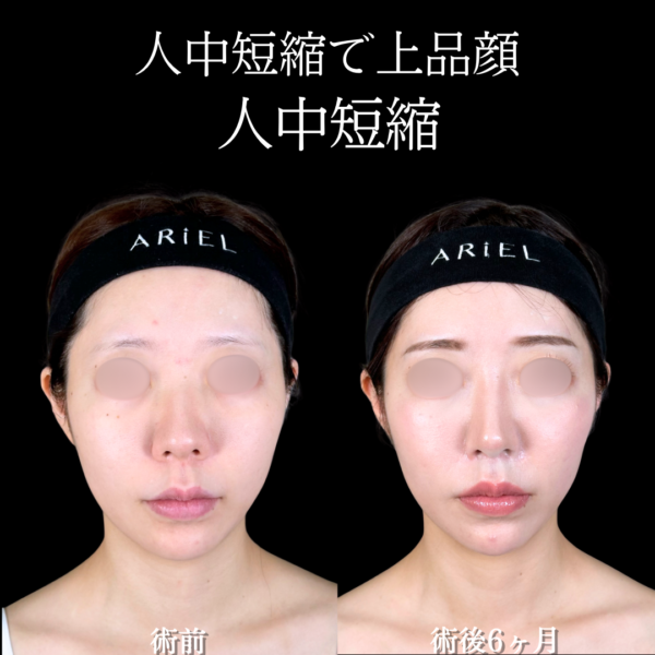 No.19672の症例写真 No.19672の症例写真