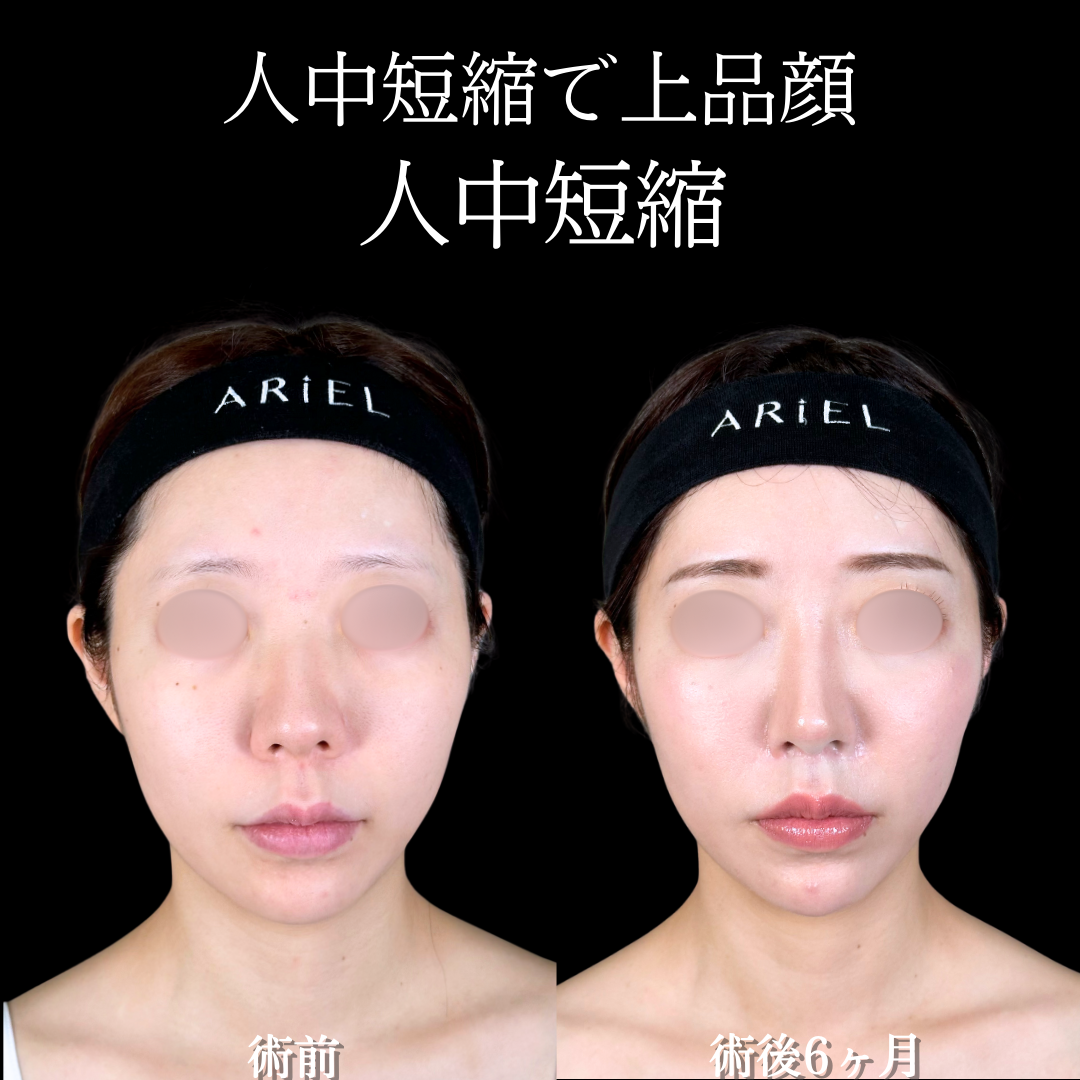 No.19672の症例写真