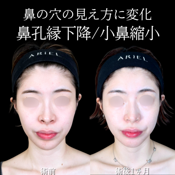 No.19689の症例写真 No.19689の症例写真