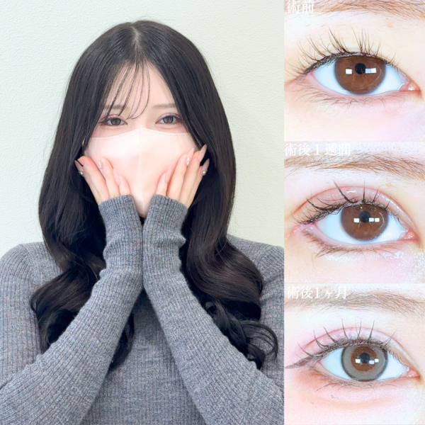 No.19690の症例写真