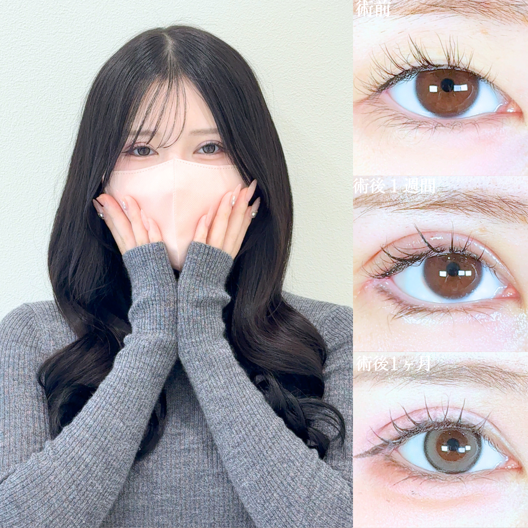 No.19690の症例写真