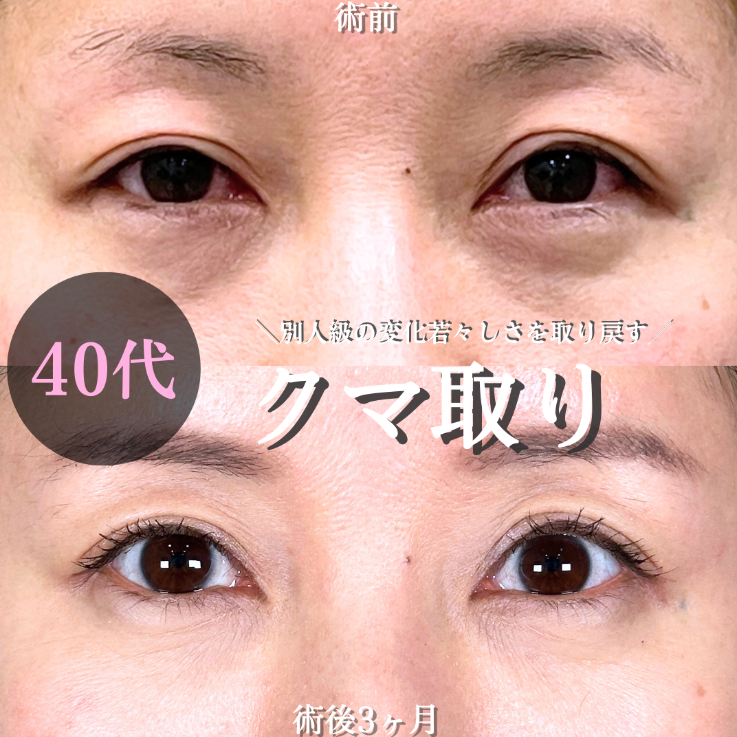 No.19701の症例写真