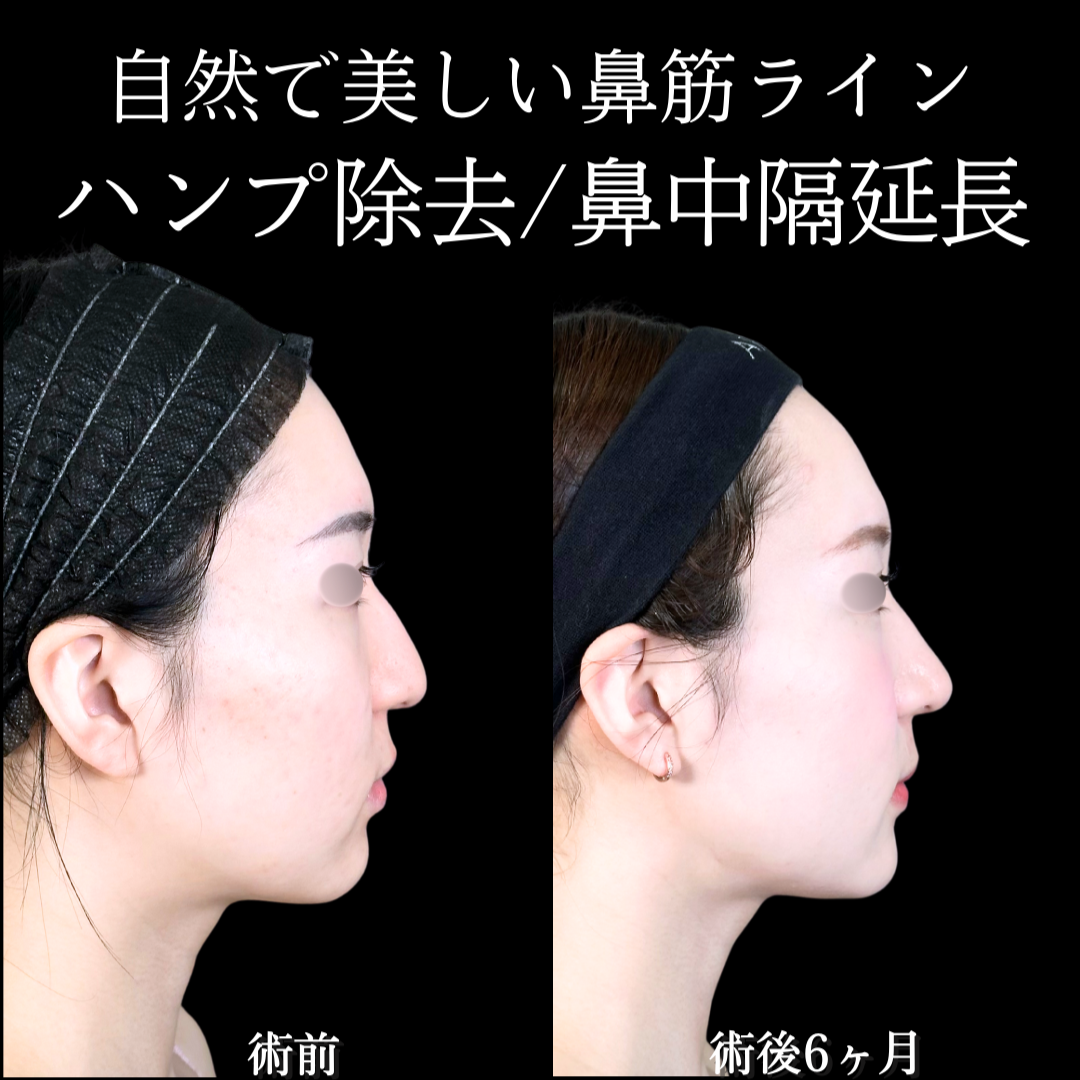 No.19720の症例写真