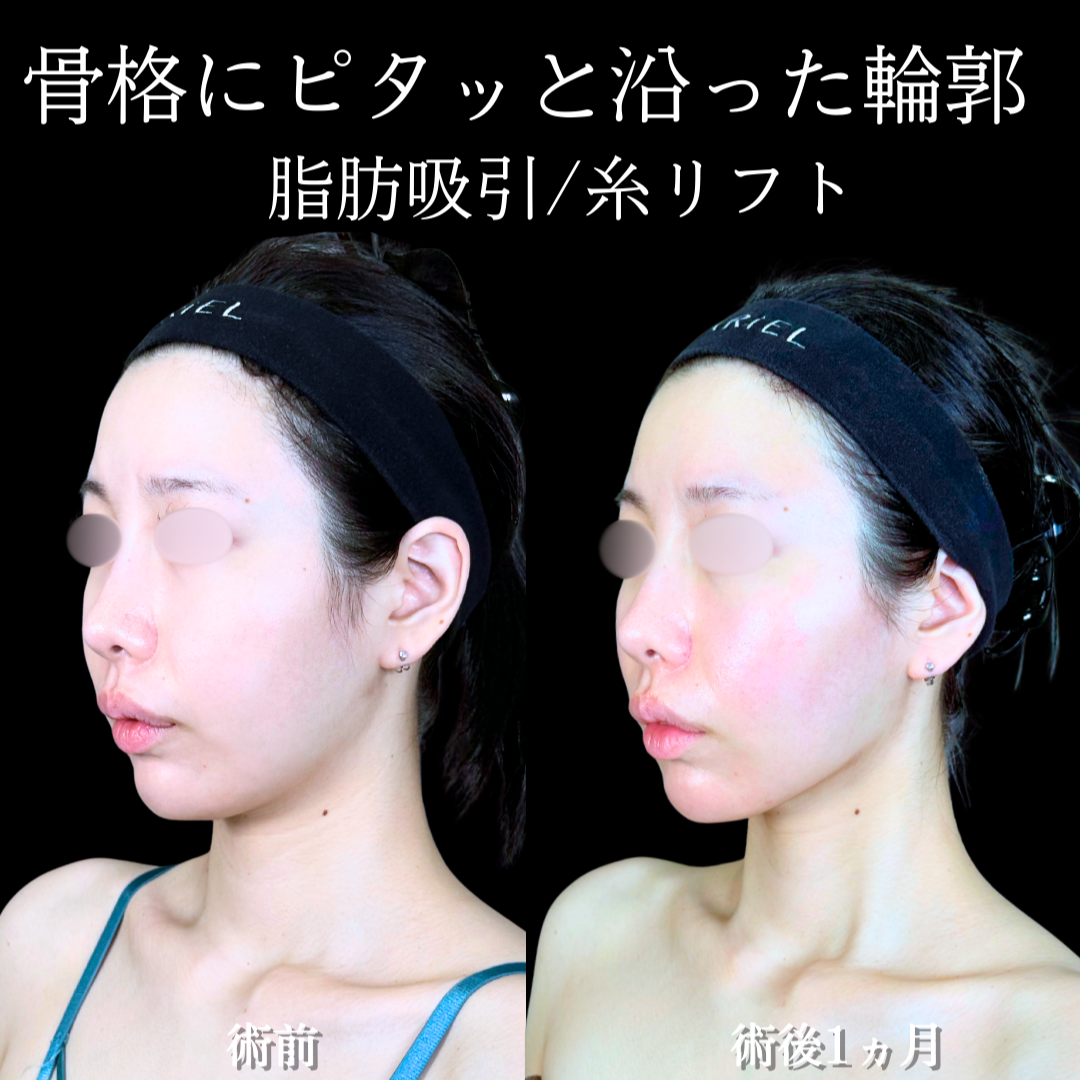 No.19743の症例写真