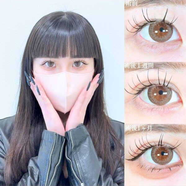 No.19483の症例写真