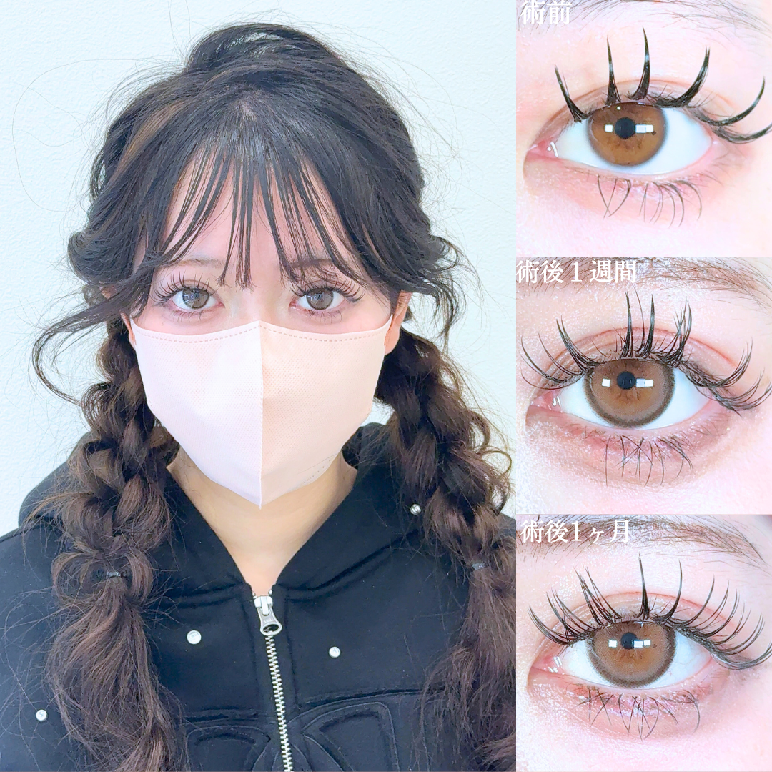 No.19439の症例写真