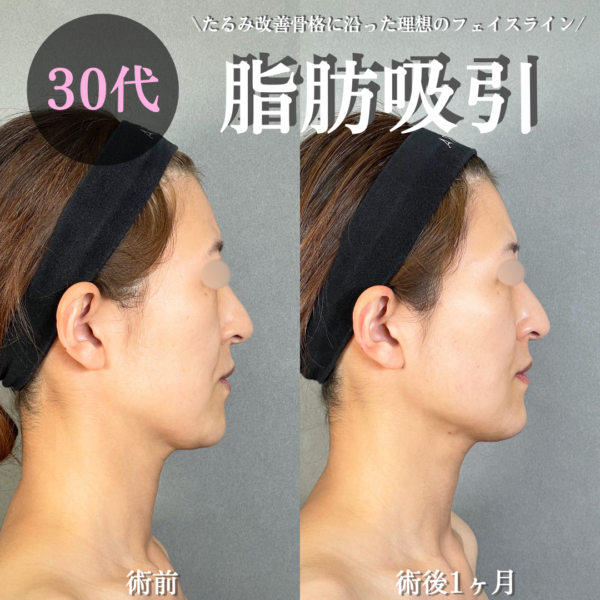 No.19460の症例写真