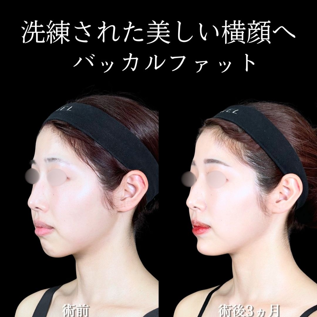 No.19642の症例写真