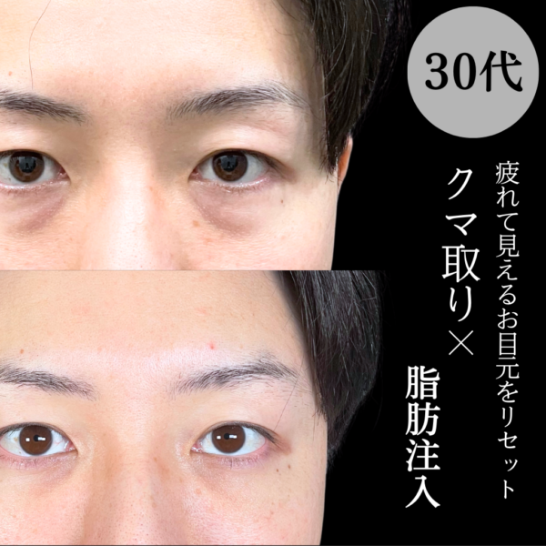 No.19481の症例写真