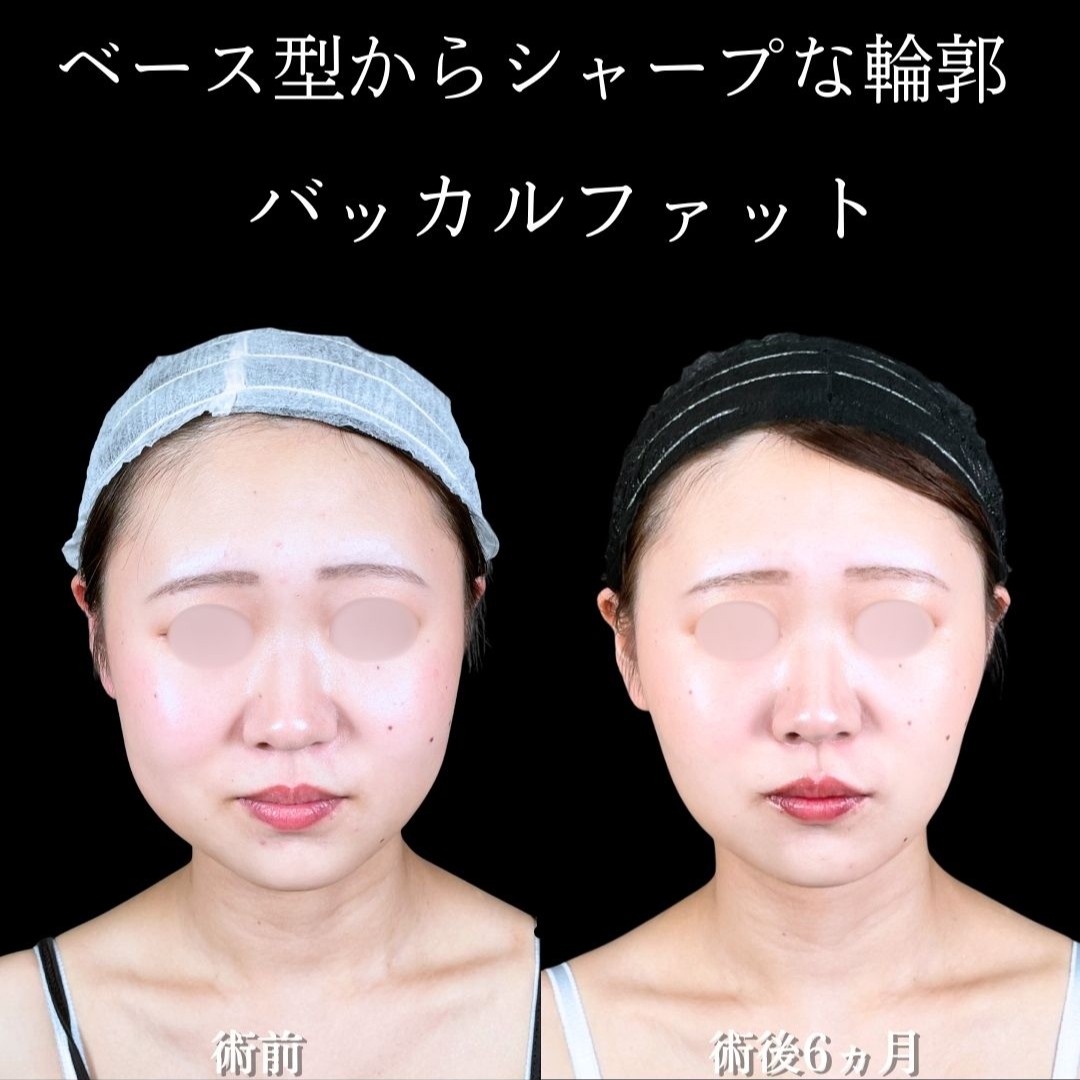 No.19707の症例写真