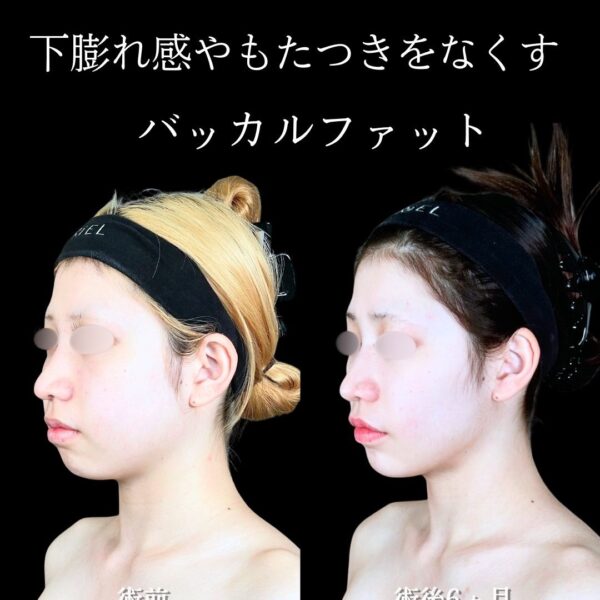 No.19751の症例写真 No.19751の症例写真