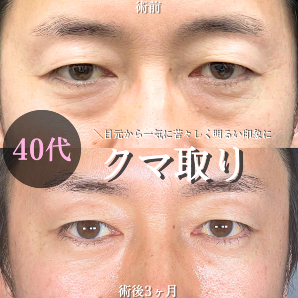 No.19506の症例写真