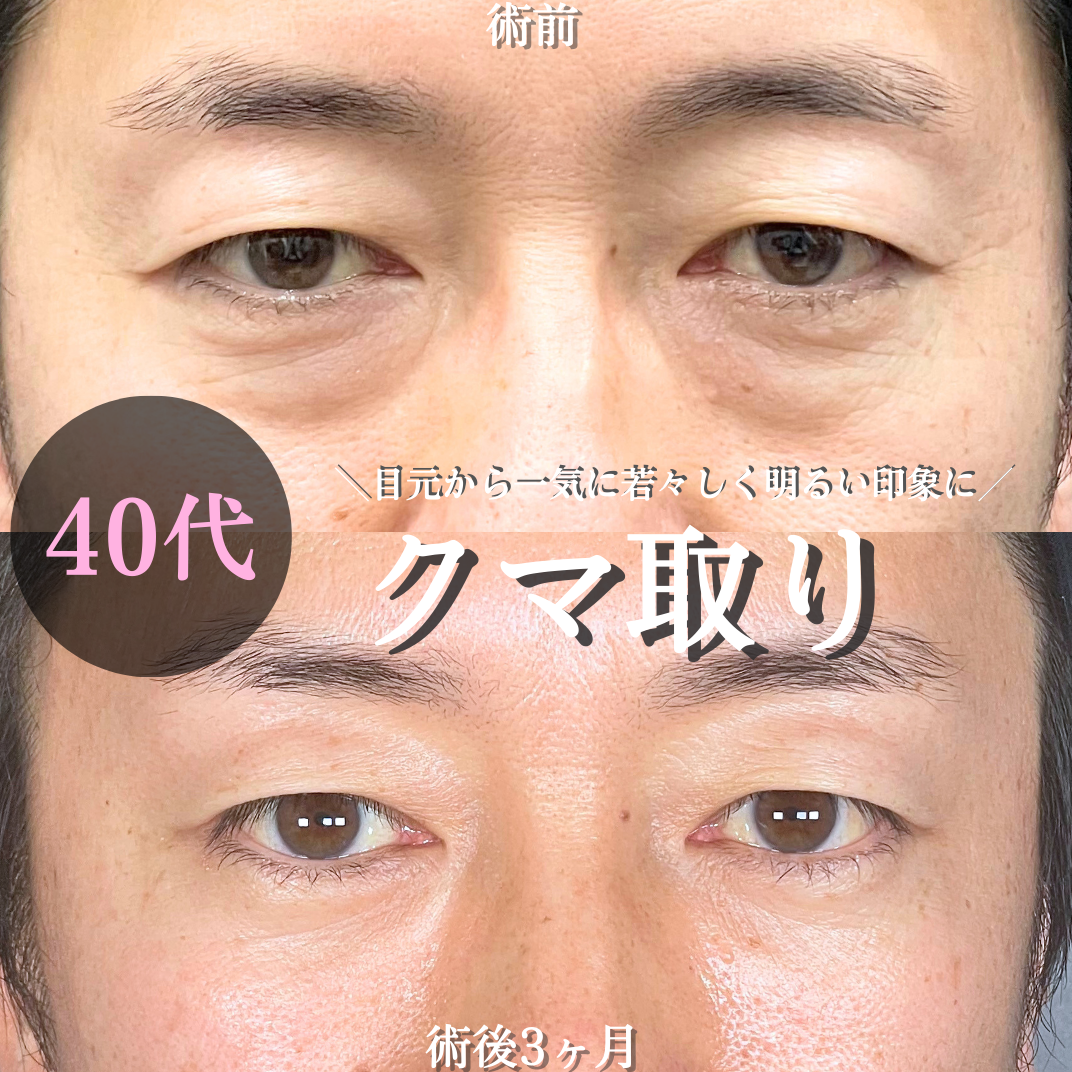 No.19506の症例写真