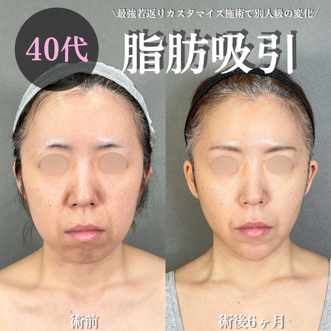 No.19602の症例写真