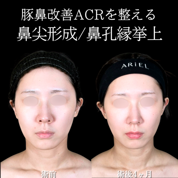 No.19403の症例写真