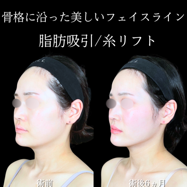 No.19609の症例写真