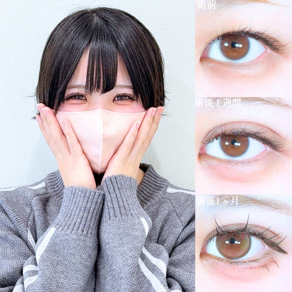 No.19616の症例写真