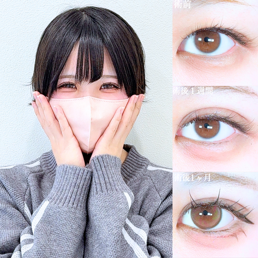 No.19616の症例写真