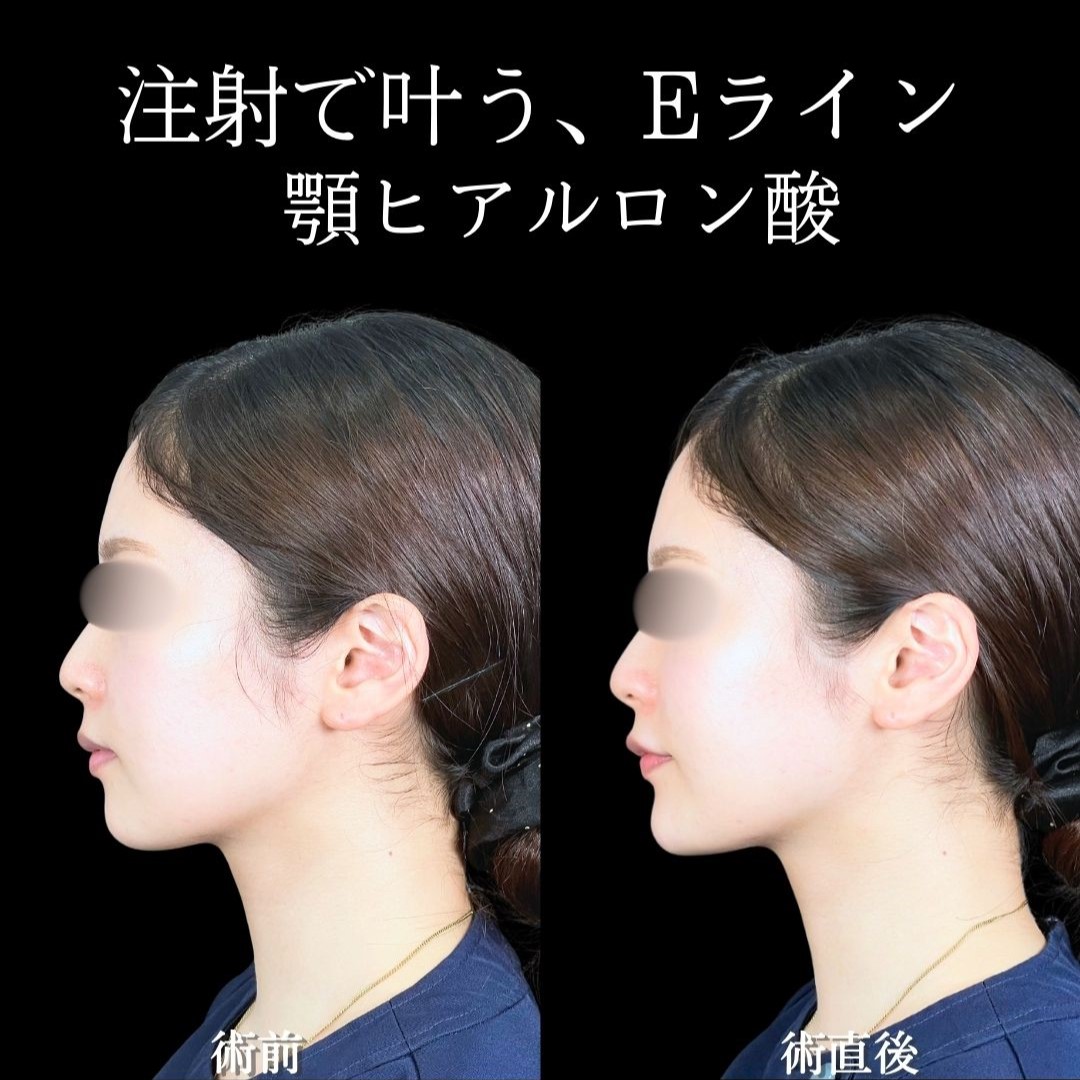 No.19382の症例写真