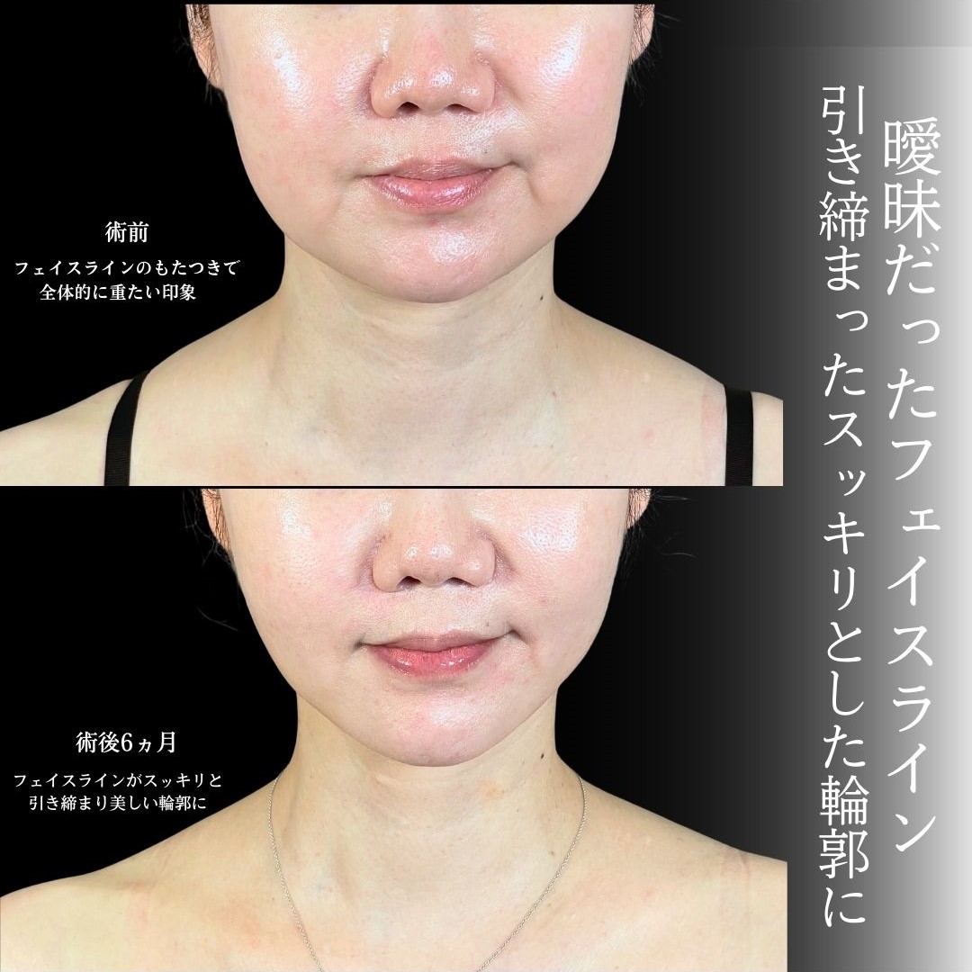 No.19432の症例写真1