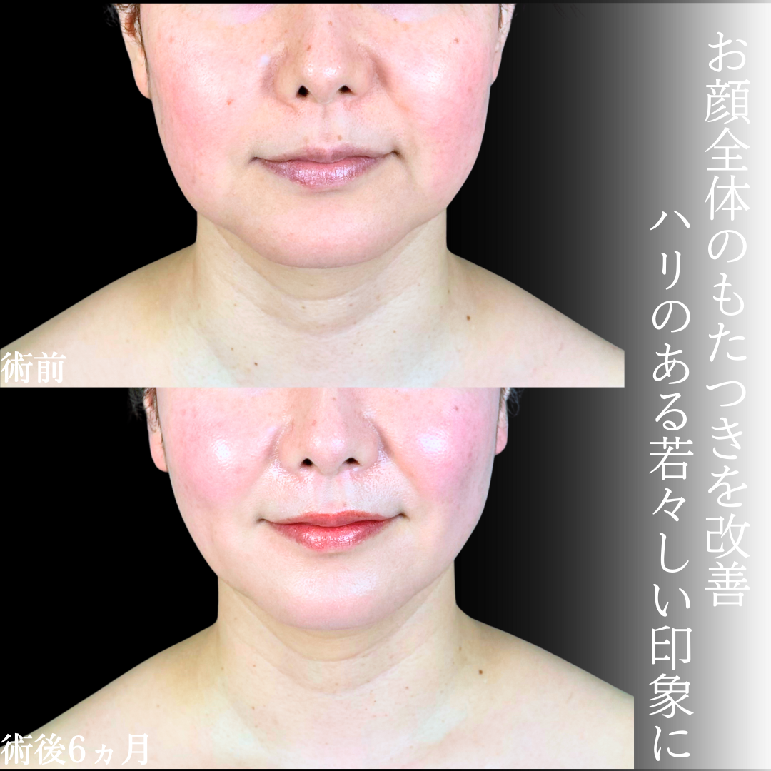 No.19640の症例写真1