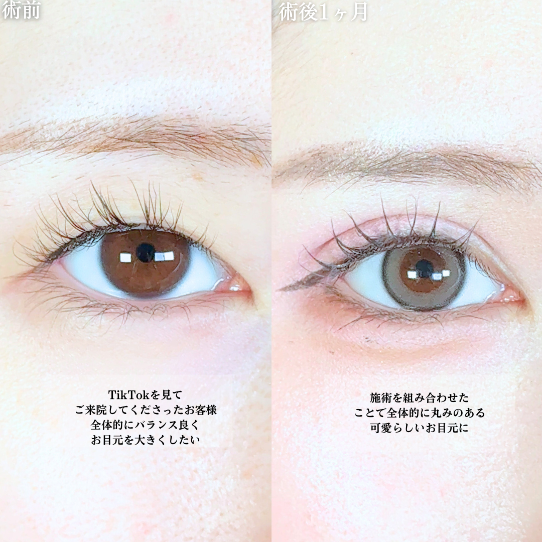 No.19690の症例写真1