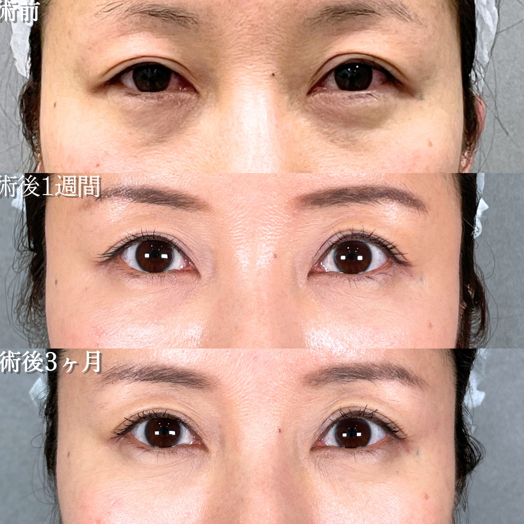 No.19701の症例写真1