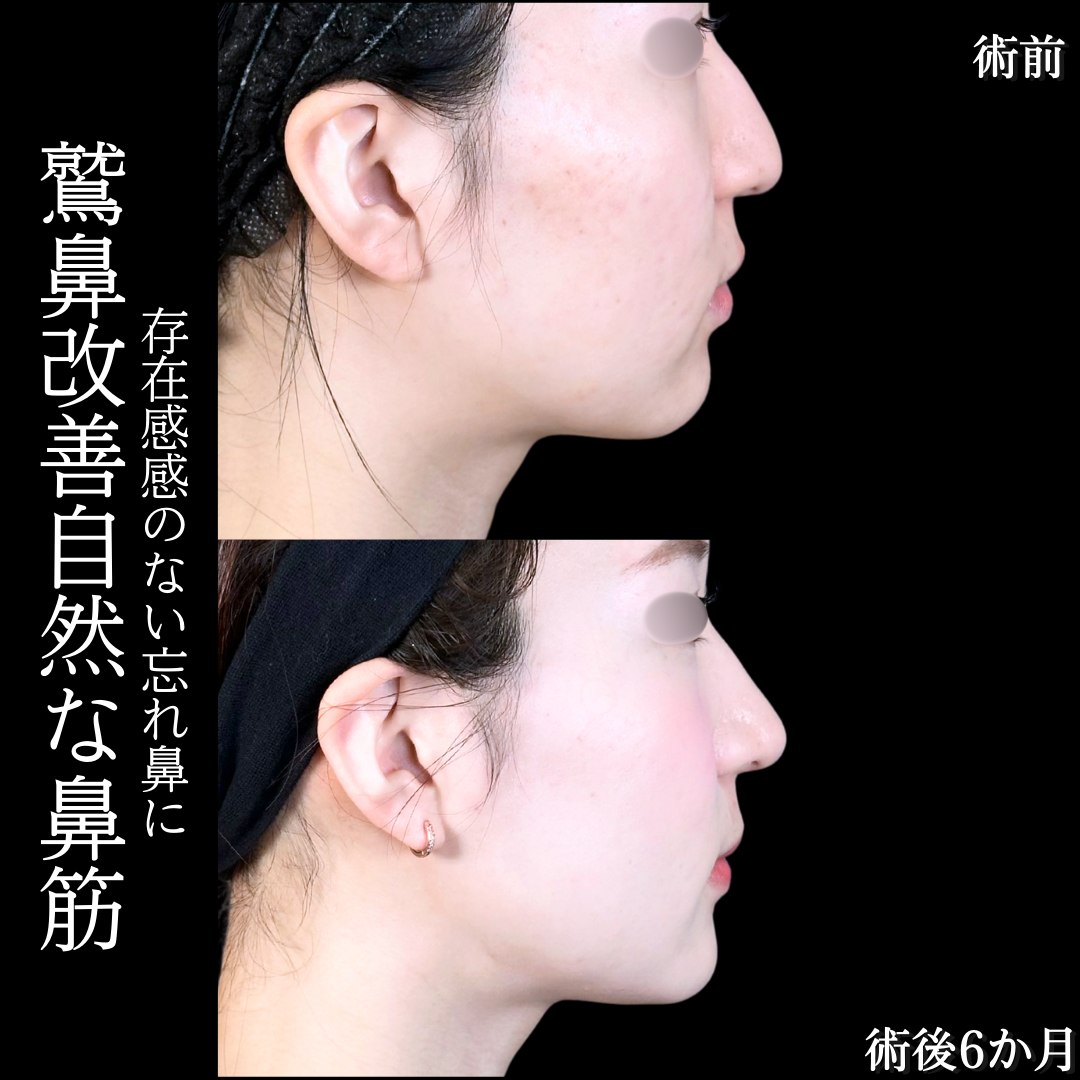 No.19720の症例写真2