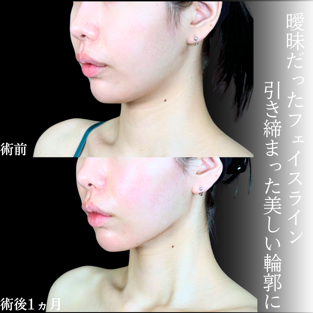 No.19743の症例写真1