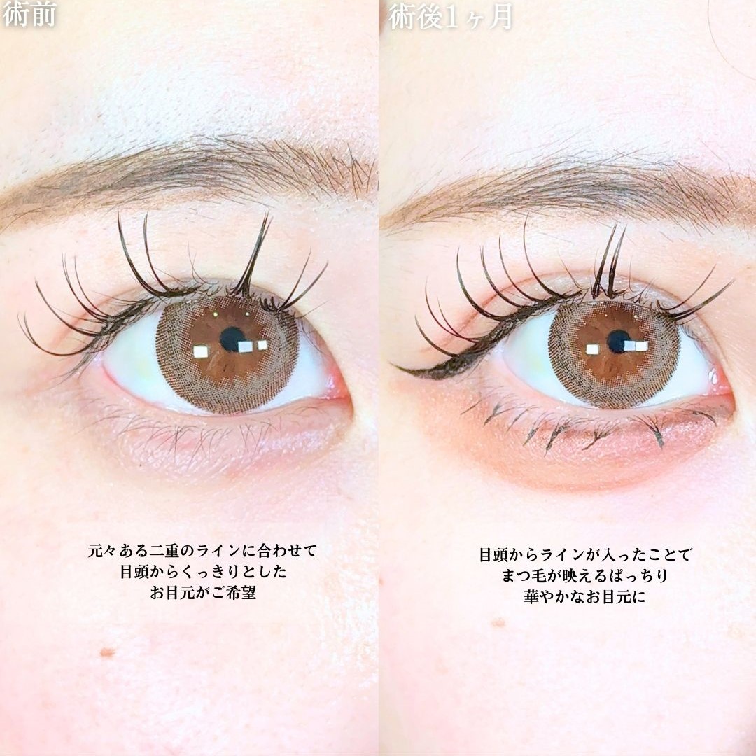 No.19483の症例写真1