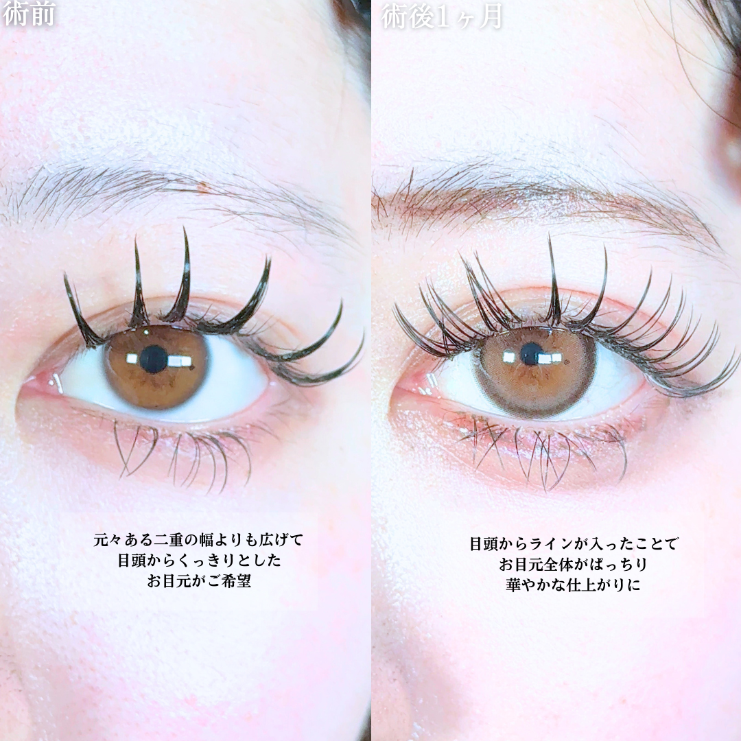 No.19439の症例写真1