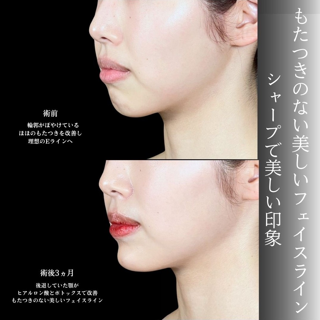 No.19642の症例写真1