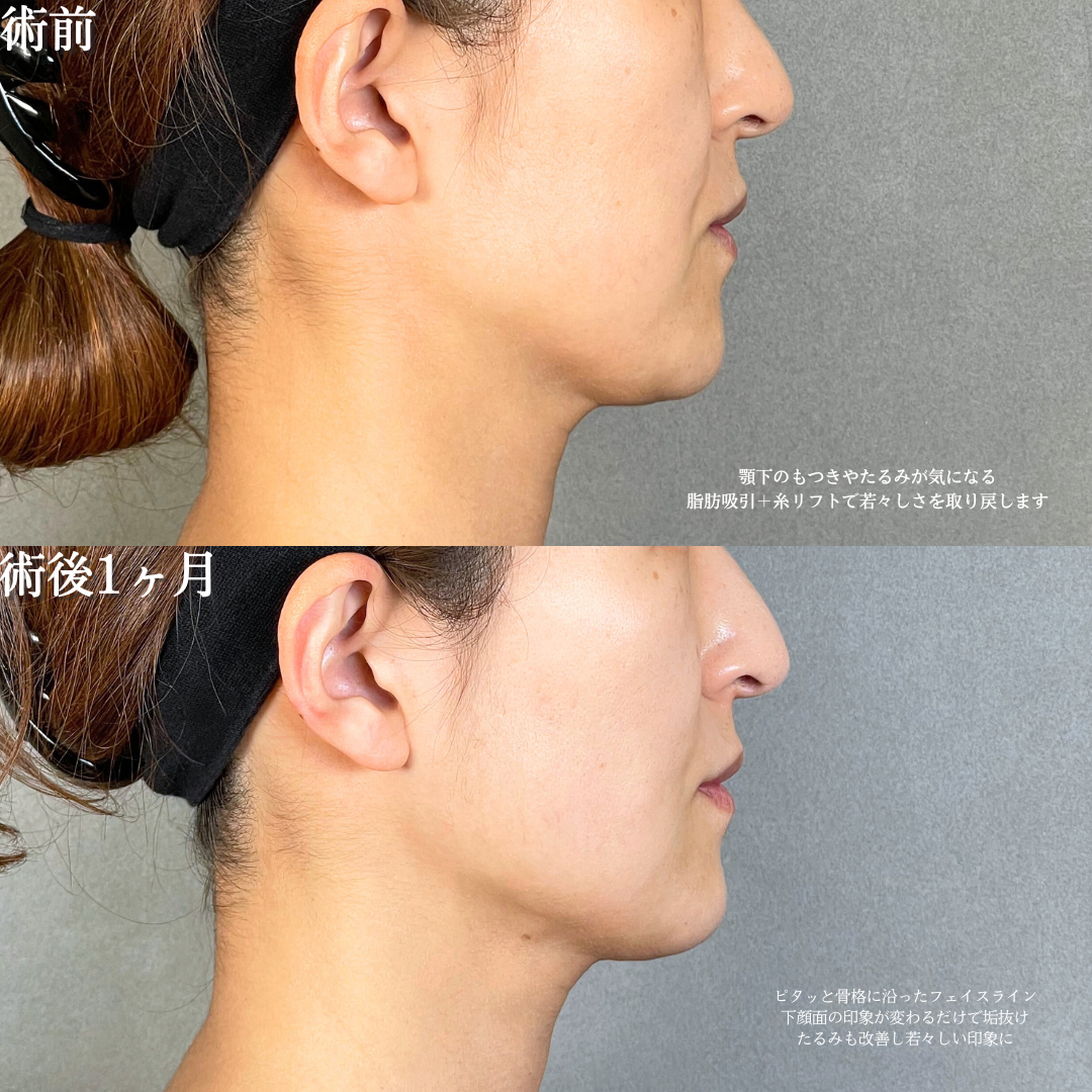 No.19460の症例写真2